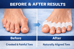 ⭐ ToeRelief Pro - Instant Pain Relief